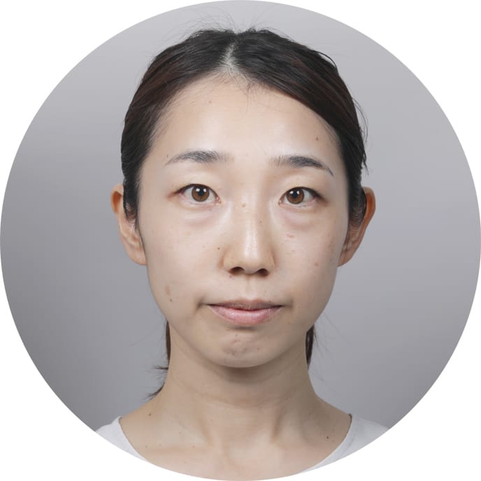 磯部様 スリーピングマスク使用前